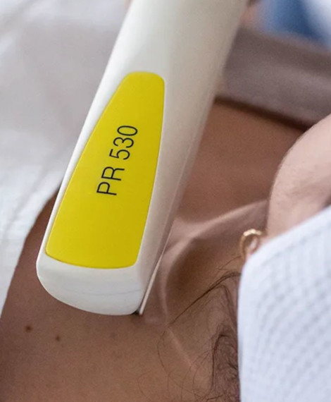 En närbild av en PR 530-enhet som används på en persons hud. Enheten har en gul etikett med modellnumret.