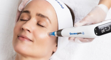 en kvinna behandlas med dermapen