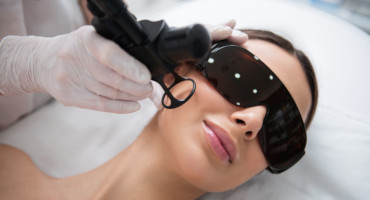 en kvinna får en fraktionerad laser behandling